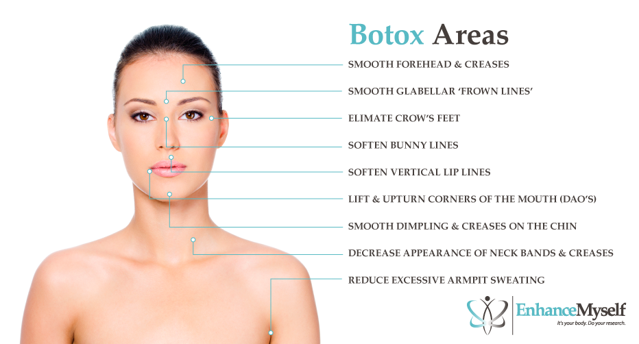 Botox Areas