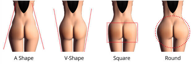Techniques for Buttocks Augmentation
