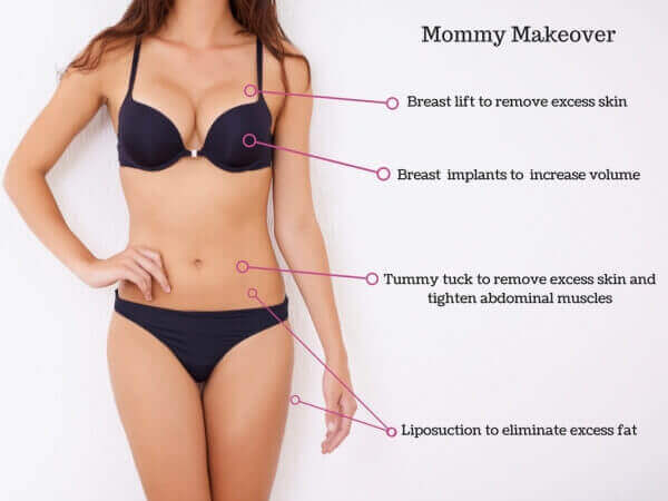 Mommy Makeover Surgery Procedure