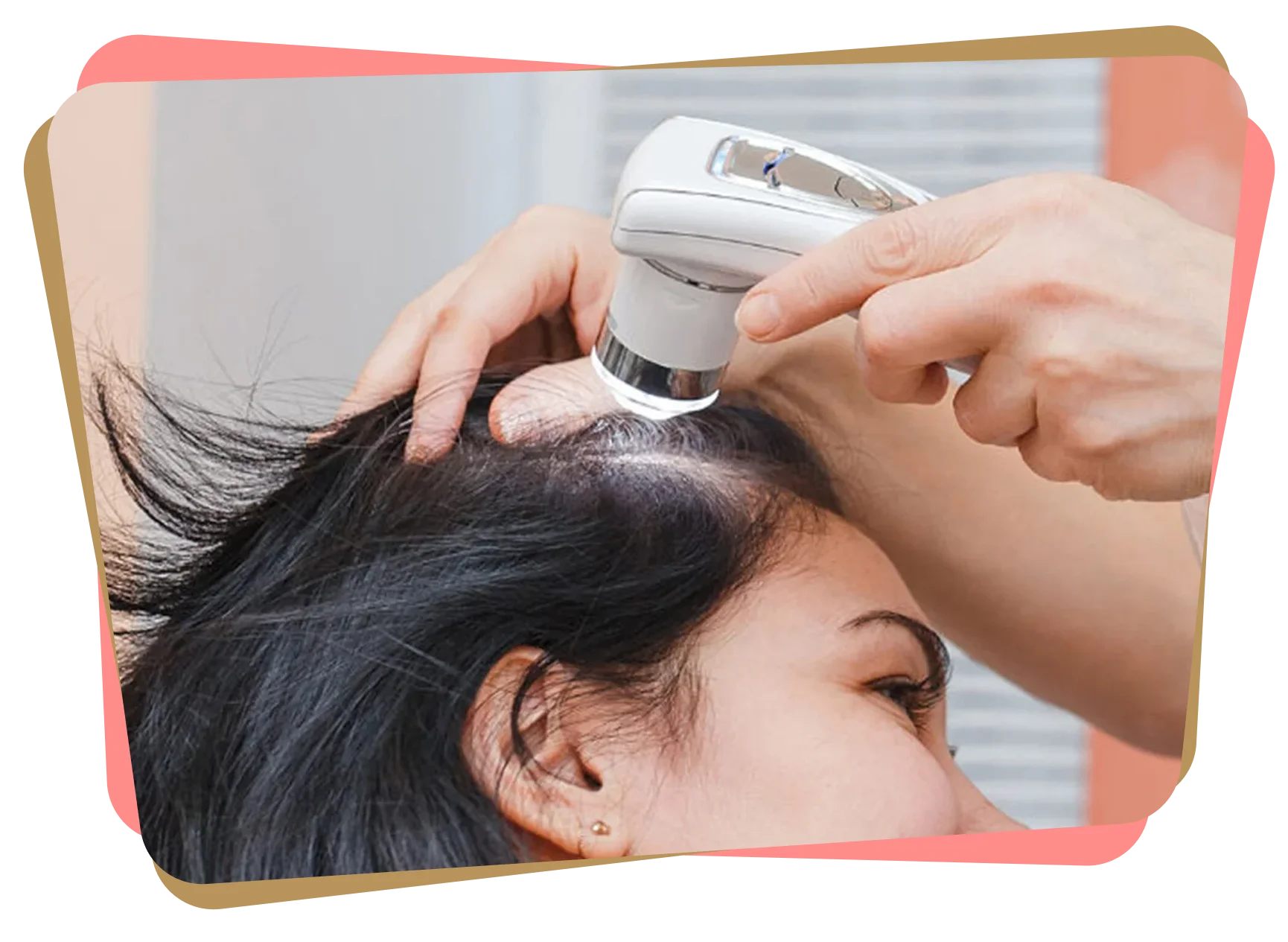 Close-up of scalp examination using a handheld diagnostic device to assess hair and scalp condition.