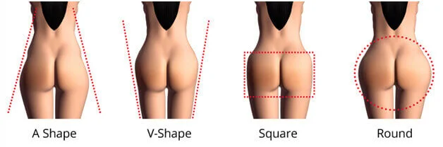 Illustration showing four buttock shapes labeled A shape, V shape, square, and round, with dotted outlines indicating contour differences.