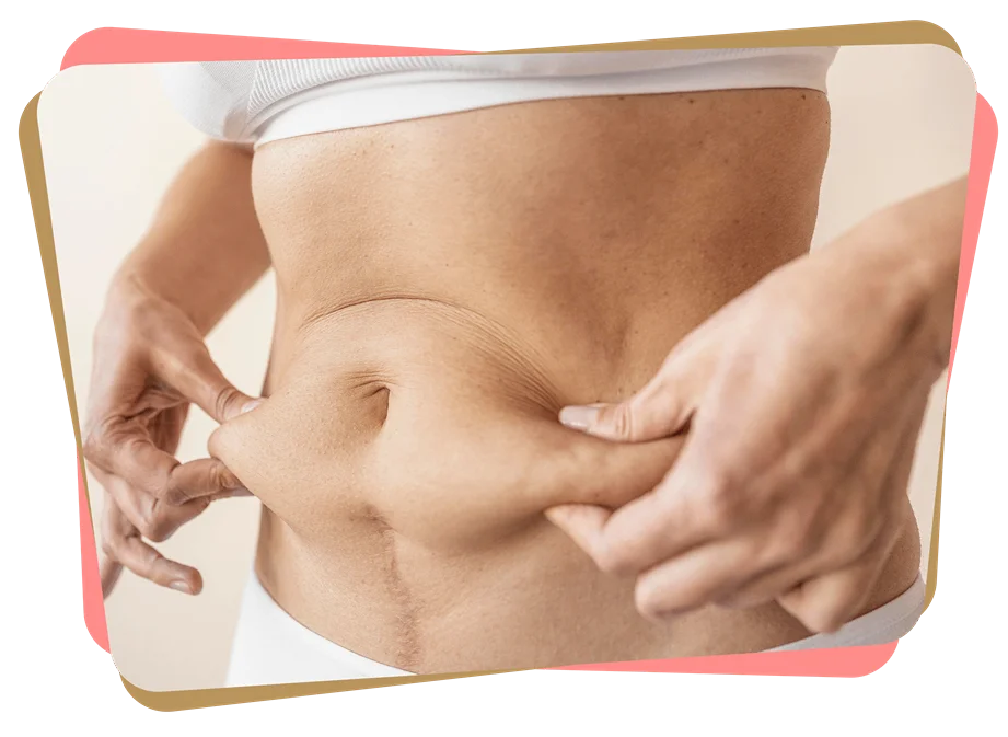 Group 260 scaled 11zon