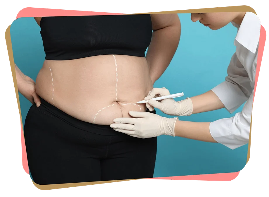 Group 261 scaled 11zon