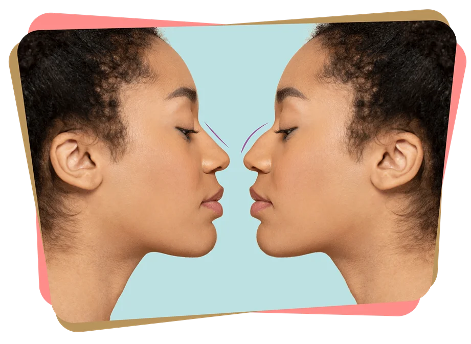 Group 262 scaled 11zon