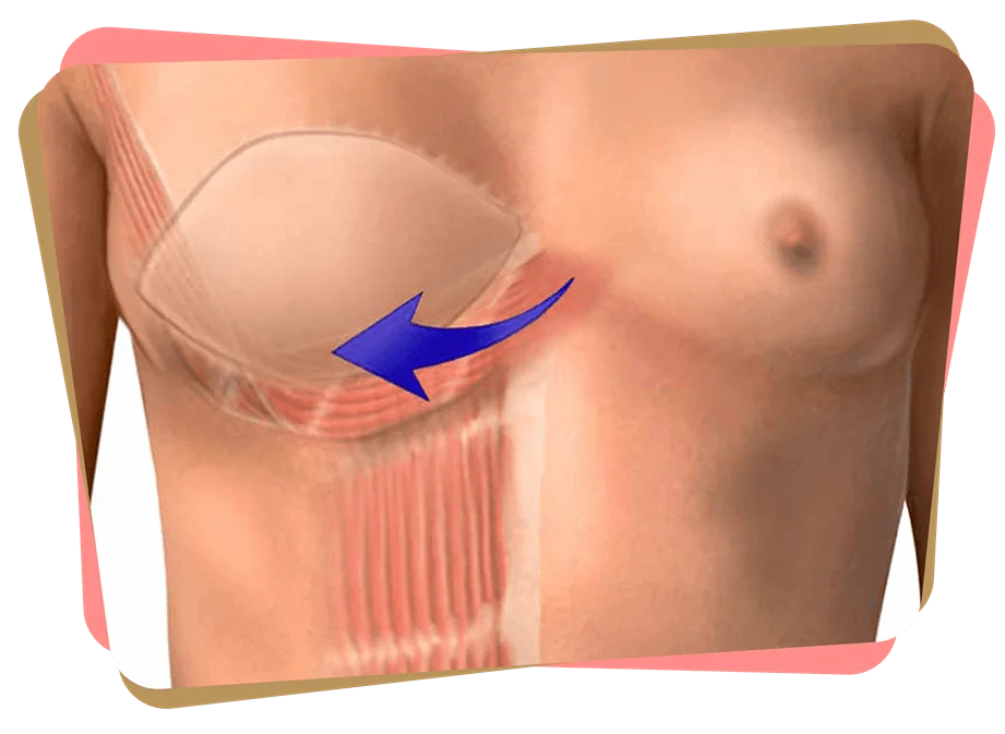 Group 267 scaled 11zon