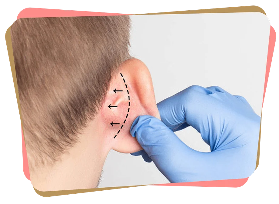 Group 333 scaled 11zon