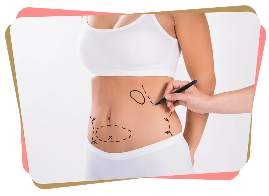 Group 339 scaled 11zon