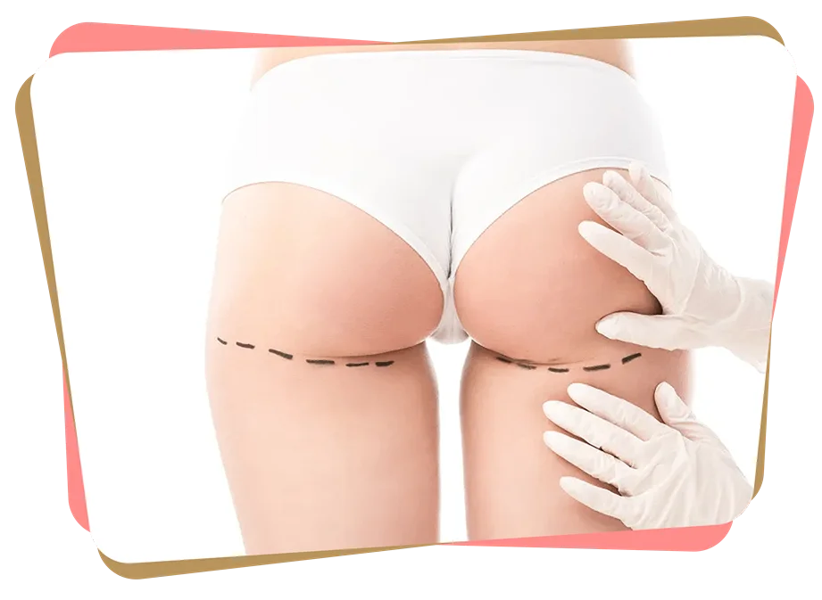 Group 410 scaled 11zon